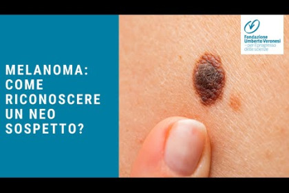 Melanoma: come riconoscere un neo sospetto?